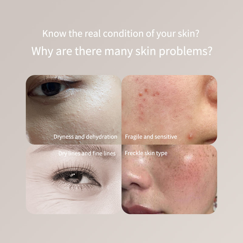 Bolígrafo probador de piel por - Skincare Only You reseña y precio